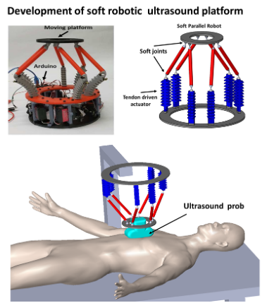 robotic ultrasound platform 